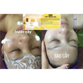 [ Spa Tại Nhà] Cấy Trắng Lụa Nano Collagen