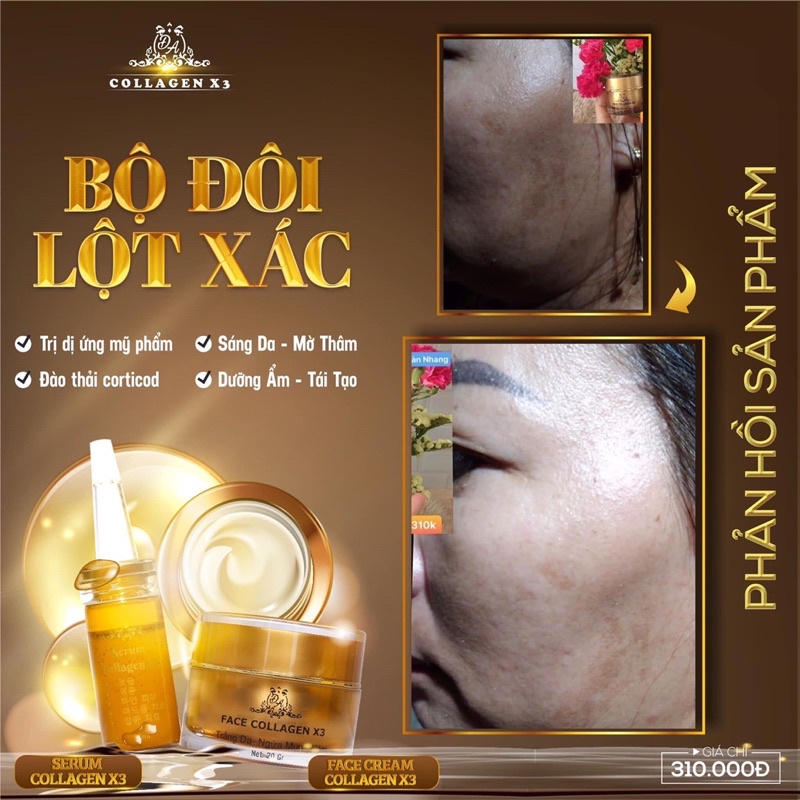 [Chính hãng] Combo Lột Xác Face + Serum Collagen X3 Mỹ Phẩm Đông Anh | BigBuy360 - bigbuy360.vn