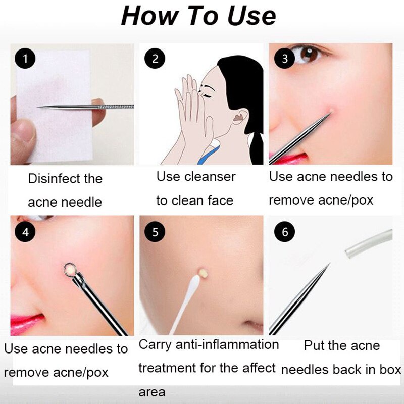 Set 4 cây nặn mụn đầu đen tiện dụng khi chăm sóc da