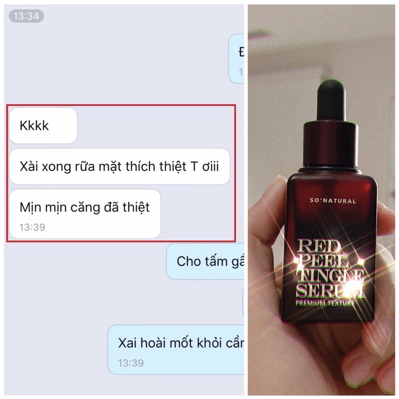 Tẩy tế bào chết Hoá Học RedPeel Tingle Serum Tái Tạo Làn Da Đẹp Chuẩn Hàn Quốc chính hãng | BigBuy360 - bigbuy360.vn