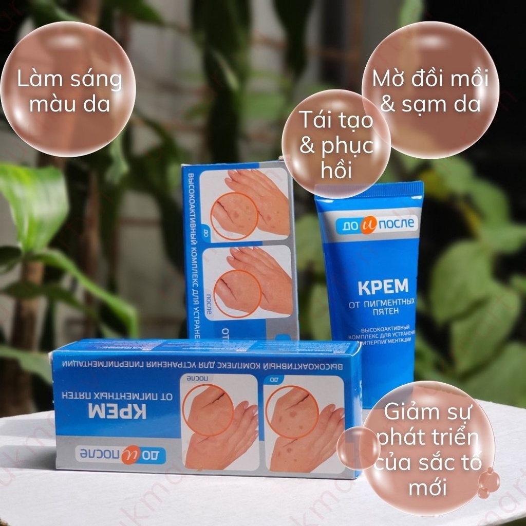 Kem Làm Giảm Đồi Mồi, Vết Nám, Sạm, Đốm Nâu Tay Chân Kpem Nga