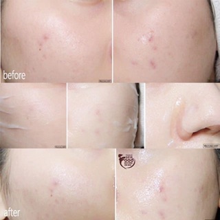 Mặt nạ Mediheal Tea Tree Care Solution Essential Mask Ex