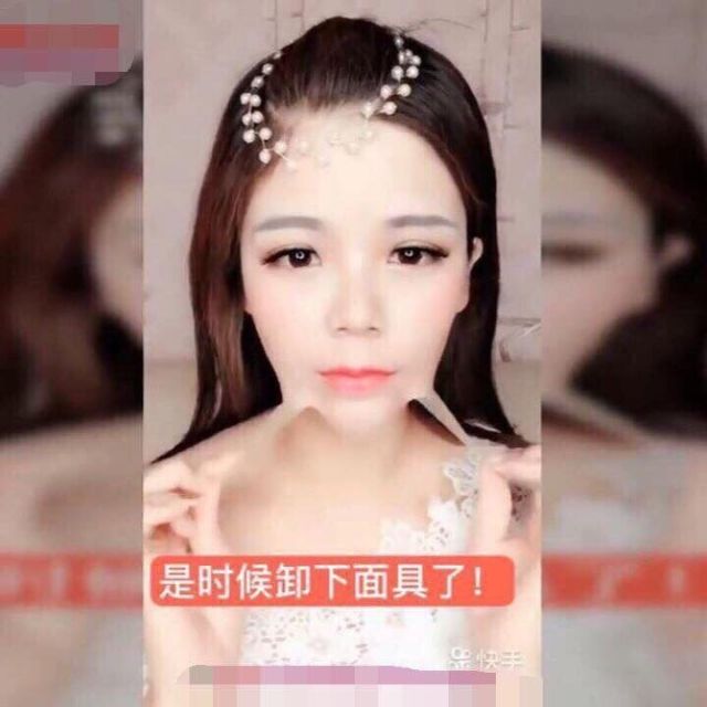 Miếng Dán Mặt Vline