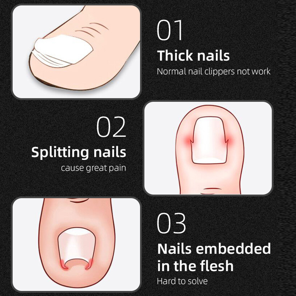 [Hàng mới về] Dụng cụ cắt da chết móng chân bằng thép không gỉ chất lượng cao