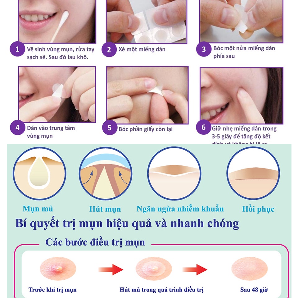 Miếng dán mụn Mayan Ultra Thin Spot giảm viêm, giảm sưng hiệu quả trong 48h