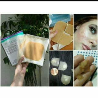 (TẶNG 1 vỉ kim châm cứu chích mụn) Miếng Dán Mụn Duoderm Extra Thin