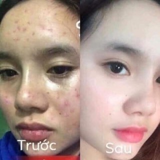Combo Kem Face Pháp 50g  + Detox Bọt Biển 80ml