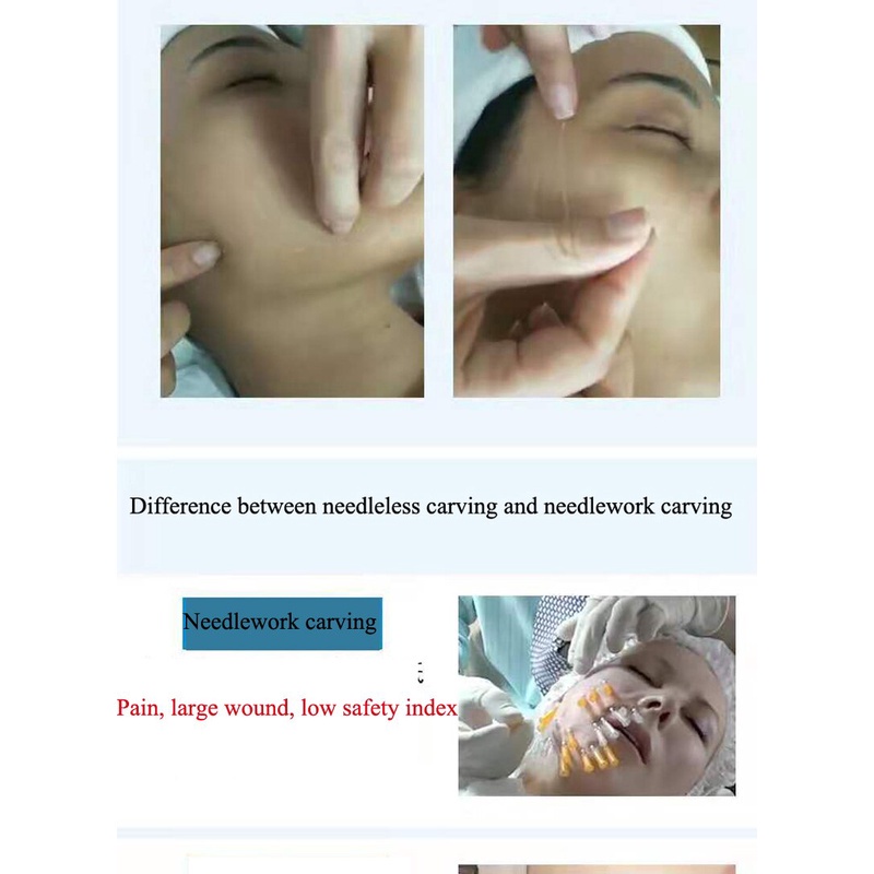 Bút Lăn Kim Protein Làm Săn Chắc Da Mặt Chống Lão Hóa Cải Thiện Nếp Nhăn Và Không Phai Màu