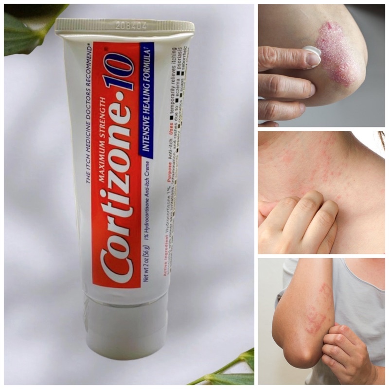 Kem Bôi Giảm Viêm Ngứa,Dị Ứng Da Cortizone 10 Maximum Strength 56g