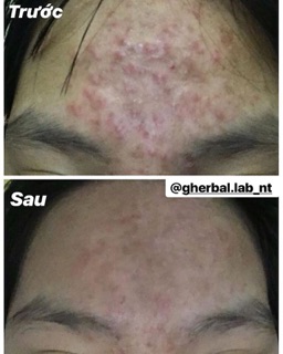 [SALE] bột diếp cá gói lớn
