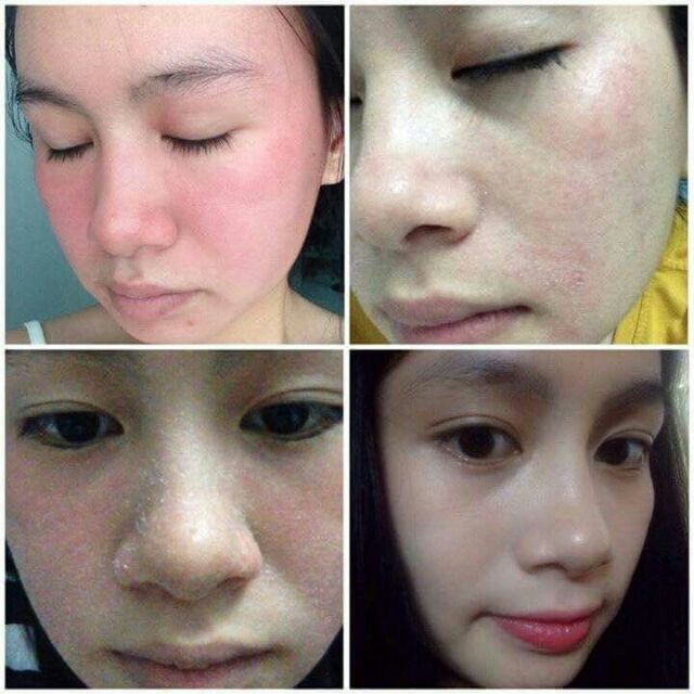 BỘT THUỐC BẮC RỬA MẶT