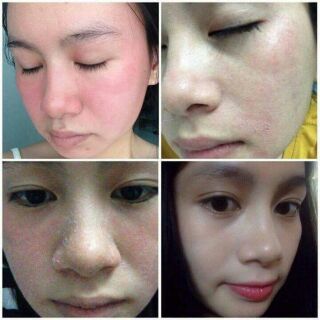 BỘT THUỐC BẮC RỬA MẶT