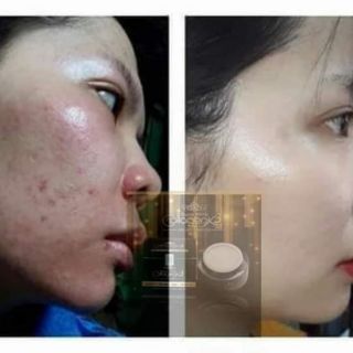 FACE Collagen X3