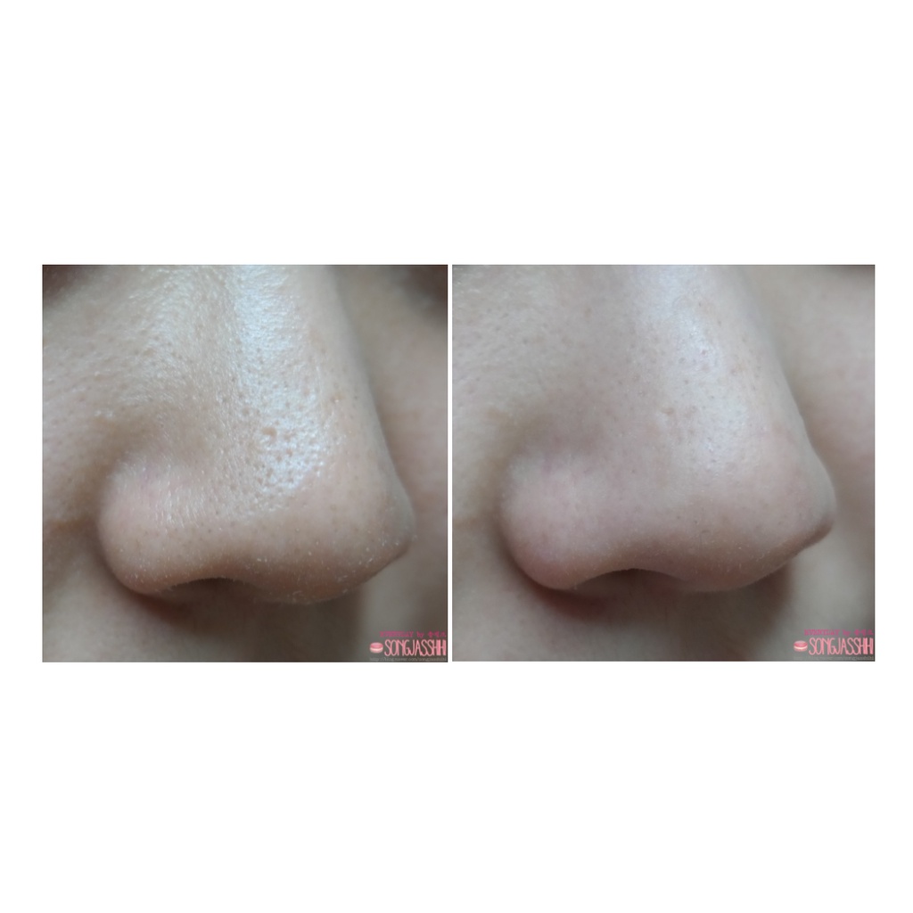 Tinh Chất Hỗ Trợ Se Khít Lỗ Chân Lông SKINMISO PORE CORSET SERUM_Mỹ phẩm Hàn Quốc chính hãng