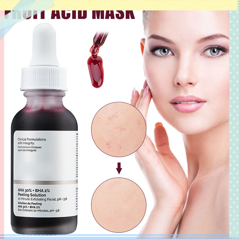 [Hàng mới về] Tinh chất loại bỏ mụn đầu đen The Ordinary AHA 30% BHA 2% dạng lột làm sáng da 30ml