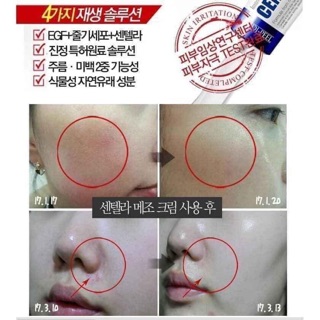 KEM CHẤM MỤN MEDIPEEL CENTELLA