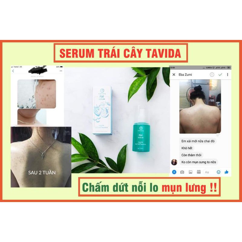 (KM MUA 2 TẶNG 1)Men vi sinh Tavida hết mụn viêm nang lông hiệu quả | Thế Giới Skin Care
