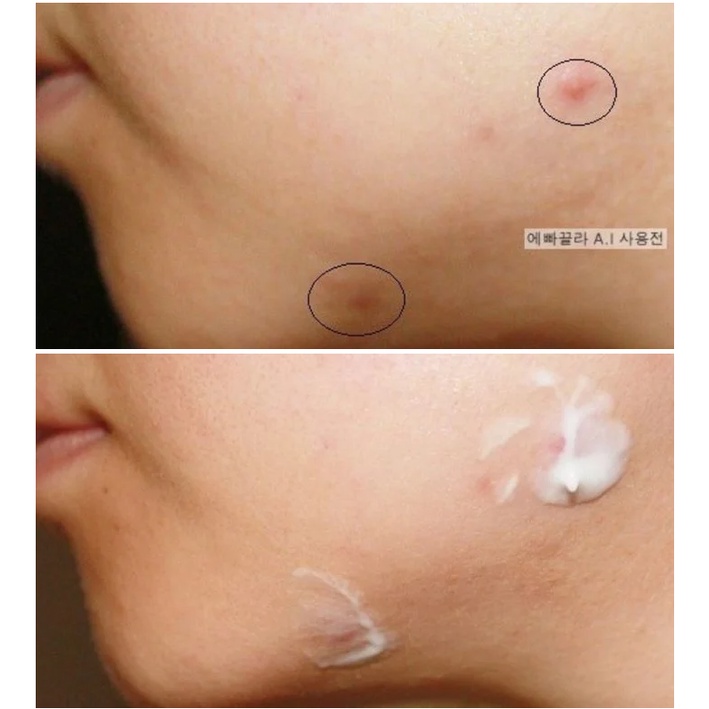Kem Chấm Mụn Chuyên Biệt La Roche-Posay Effaclar A.I. Targeted Breakout Corrector 15ml