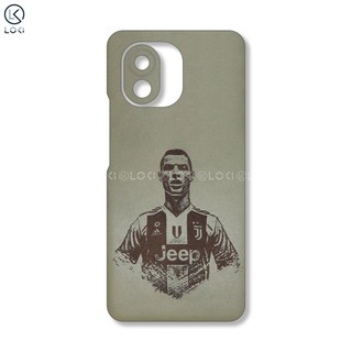 Dán da Xiaomi Mi 11 theo yêu cầu