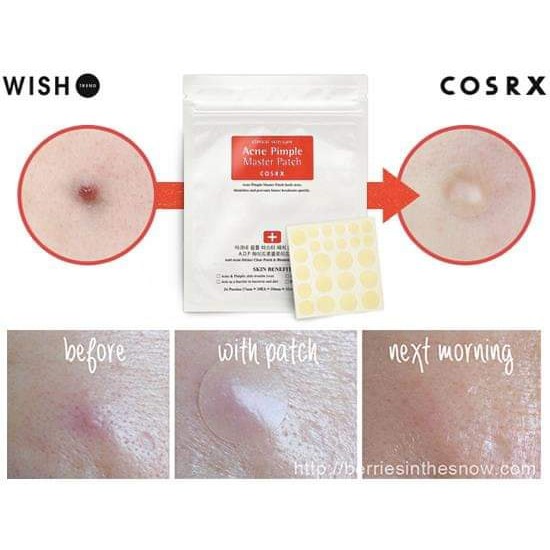 Miếng dán mụn Cosrx Master Patch 24 miếng hút mủ tốt