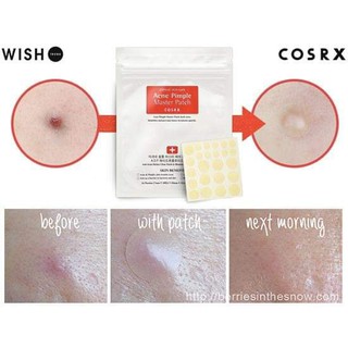 Miếng dán mụn Cosrx Master Patch 24 miếng hút mủ tốt
