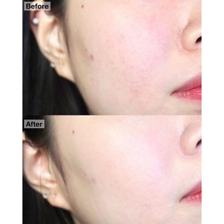 𝐒𝐄𝐓 𝐏𝐇Ấ𝐍 𝐍ƯỚ𝐂 𝐄𝐒𝐏𝐎𝐈𝐑 𝐏𝐑𝐎𝐓𝐀𝐈𝐋𝐎𝐑 𝐁𝐄 𝐕𝐄𝐋𝐕𝐄𝐓 𝐂𝐎𝐕𝐄𝐑 𝐂𝐔𝐒𝐇𝐈𝐎𝐍