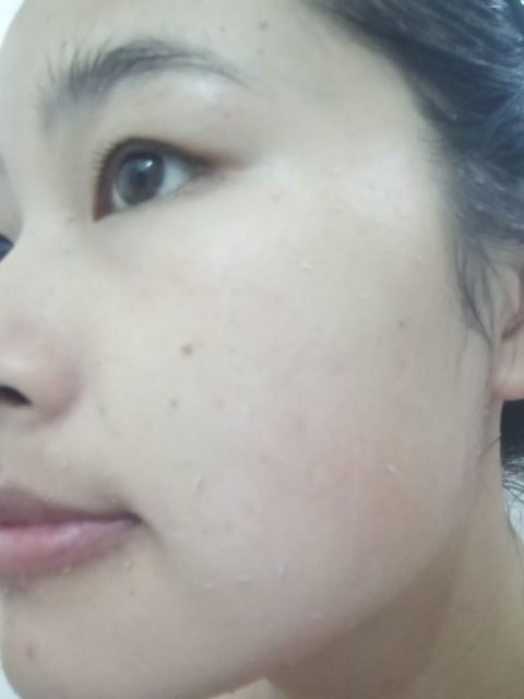 TẨY TẾ BÀO CHẾT (mẫu mới) | BigBuy360 - bigbuy360.vn