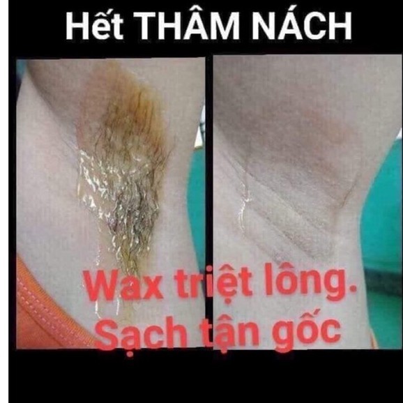 Combo triệt lông vĩnh viễn An Lành (tặng giấy và que wax)