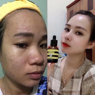 SERUM KOSXU (TẶNG QUÀ)