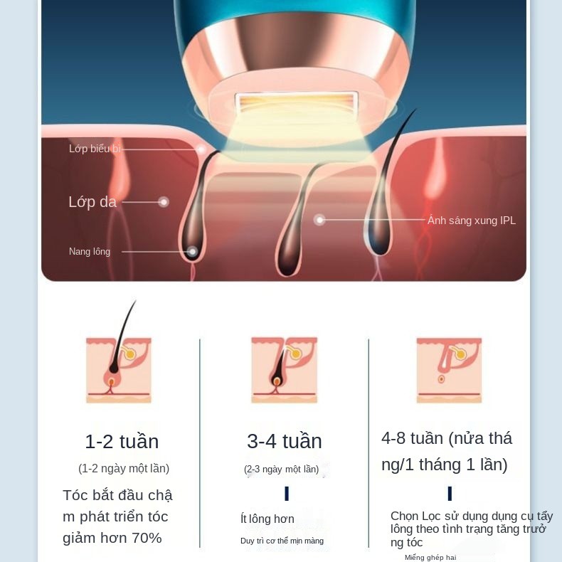 máy triệt lông điểm đông lạnh laser tại nhà cạo tay, chân nghệ thuật tẩy nách và Toàn thân Bộ phận riêng tư Dao r