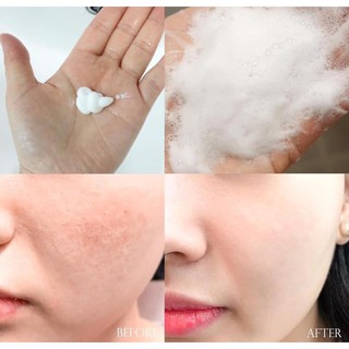 SỮA RỬA MẶT ACNE SOME BY MI
