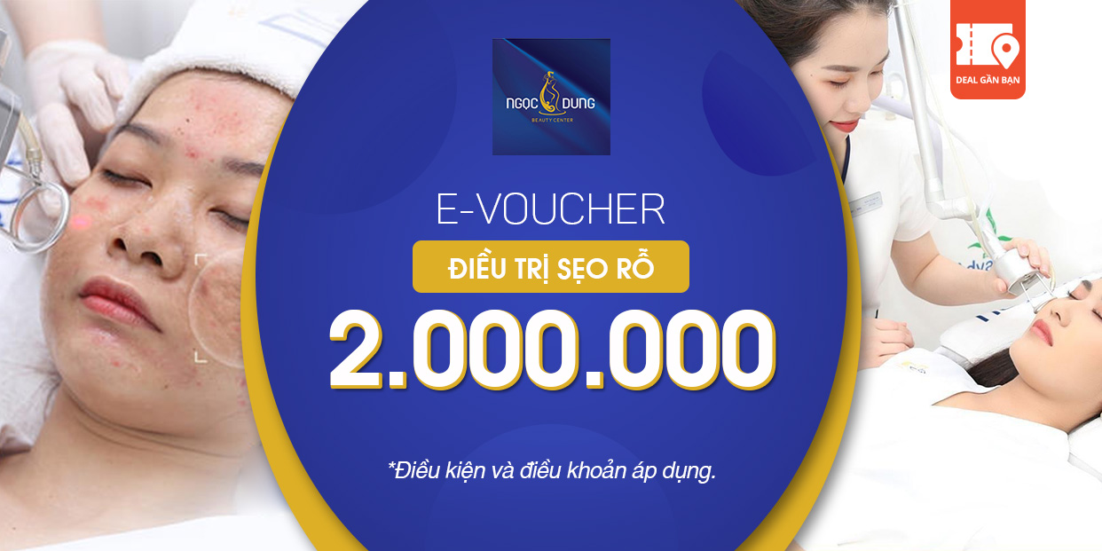 E-Voucher TMV Ngọc Dung Điều Trị Sẹo Rỗ Bằng Laser