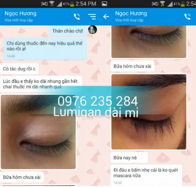Lumigan Thuốc mọc dài mi của Mỹ | BigBuy360 - bigbuy360.vn