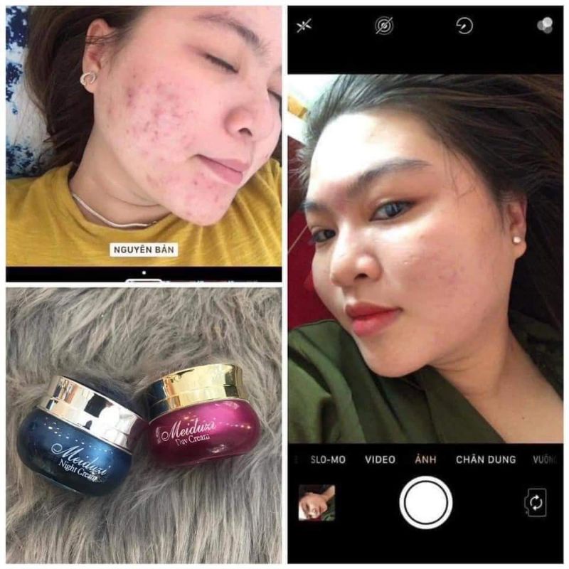 Kem Face Meiduzi Nhật Bản chính hãng