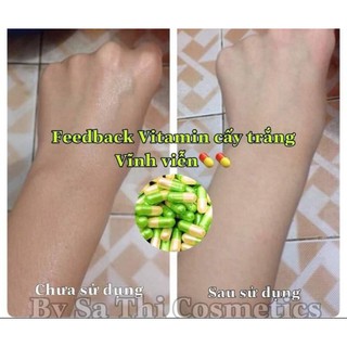 COMBO 100 VIÊN VITAMIN CẤY TRẮNG SA THỊ