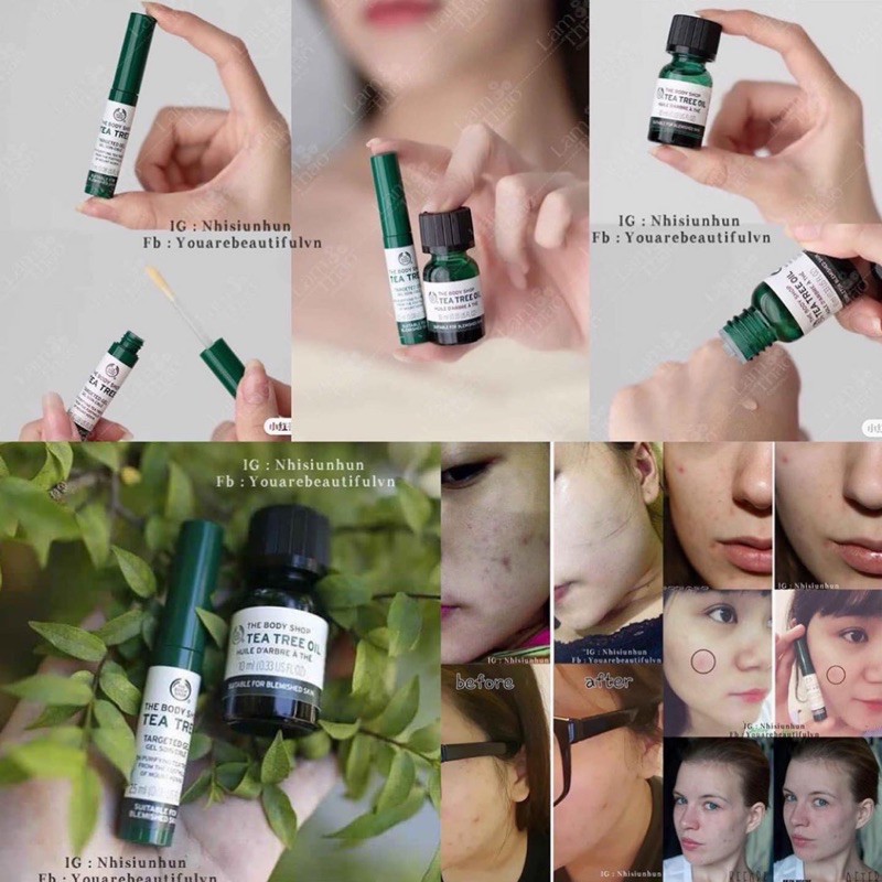 Tinh dầu Tea Tree Oil The Body Shop