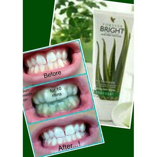 Kem đánh răng lô hội 028 Forever Bright Toothgel