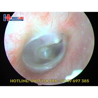Máy nội soi tai mũi họng nguồn sáng lạnh xd-301 cho bệnh nhân - ảnh sản phẩm 8
