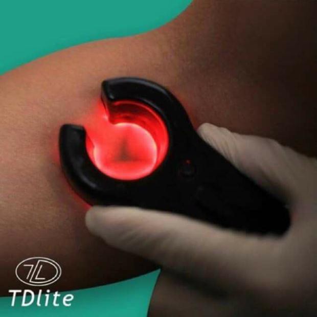 Đèn soi tĩnh mạch ,rò ven lấy ven dùng trong spa thẫm mỹ viện