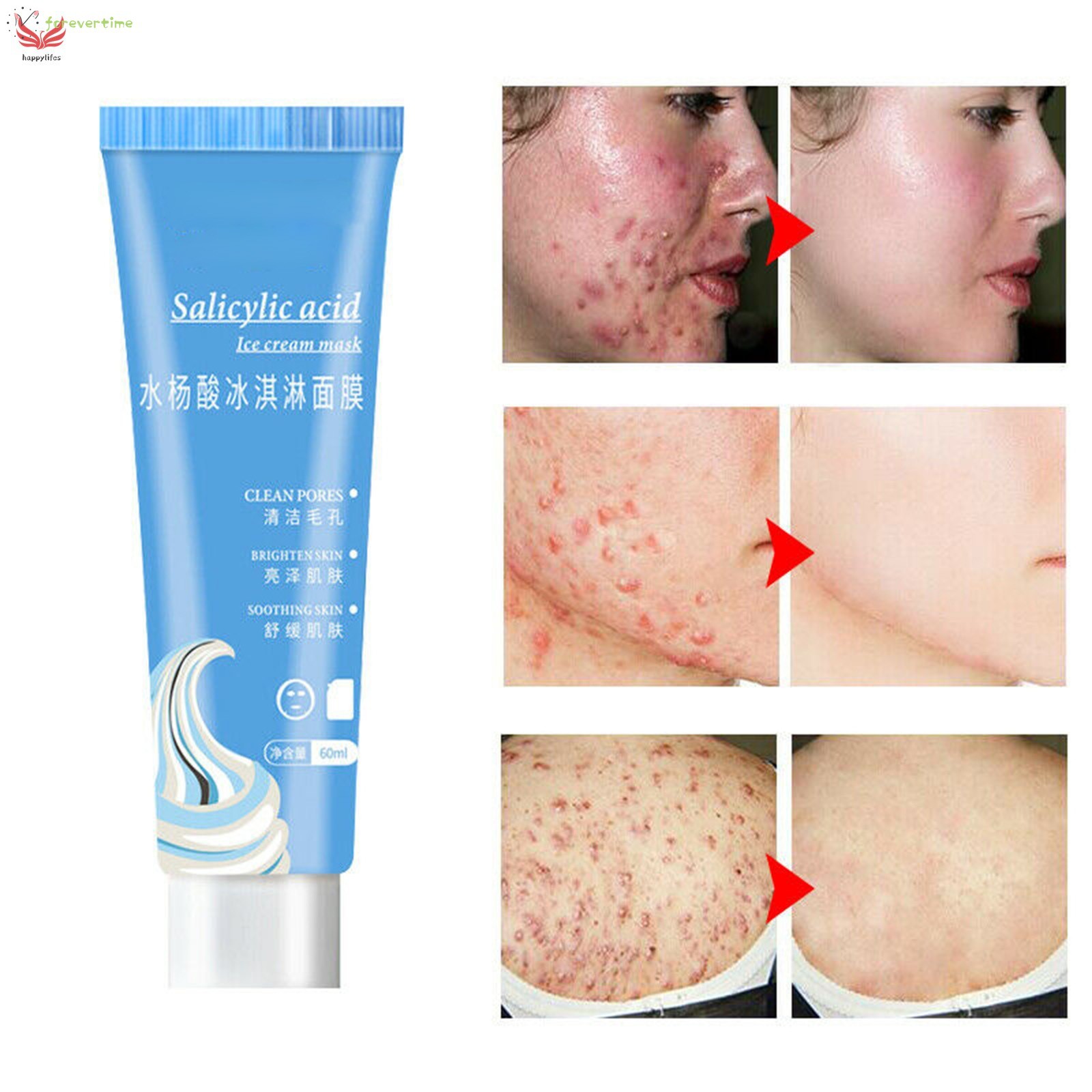 Ready Stock Mặt Nạ Dạng Kem Chứa Axit Salicylic Giúp Cải Thiện Da Mụn Đầu Đen Và Dưỡng Ẩm