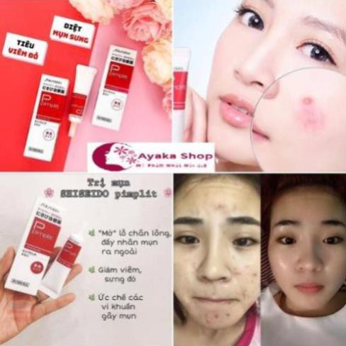 nam2k6ahihi Kem ngăn ngừa mụn Shiseido Pimplit 18g Chuyên Cho Mụn Bọc Mụn Sưng -Mỹ Phẩm Nhật Nôi Đia AyakaShop. Ma20s