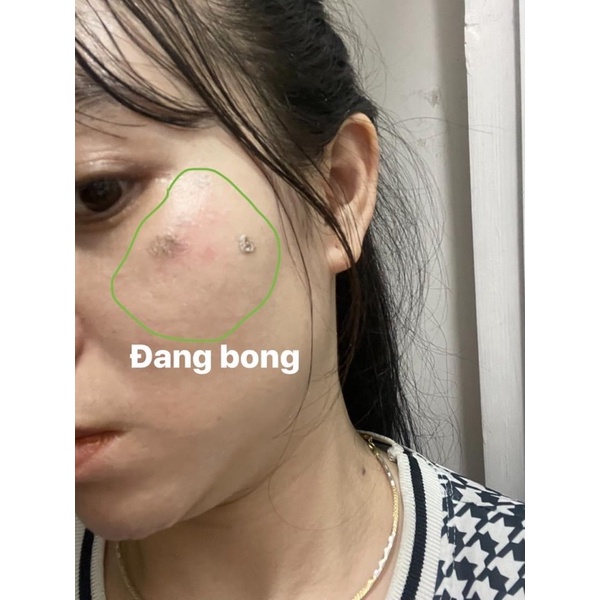 Phân giải sắc tố B1 tái tạo da loại 1 ngăn ngừa thâm, nám mảng, tàn nhang, chống tăng sắc tố Handmde