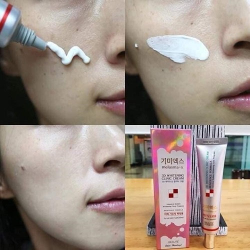 Kem Nám Melasma-X 3D Whitening Clinic Dưỡng TRắng Ngừa Nám Tàn Nhang