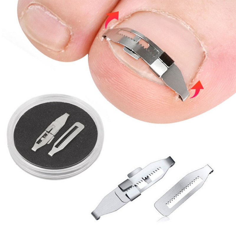 Bộ Dụng Cụ Chỉnh Sửa Móng Chân Mọc Ngược YOUYO Paronychia