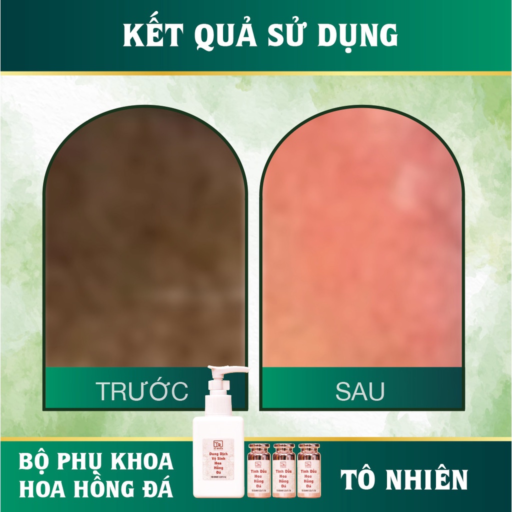 Dung dịch vệ sinh phụ nữ hồng mịn se khít Tô Nhiên giảm khí hư, ngứa an toàn cho cả mẹ bầu & sau sinh 130ml