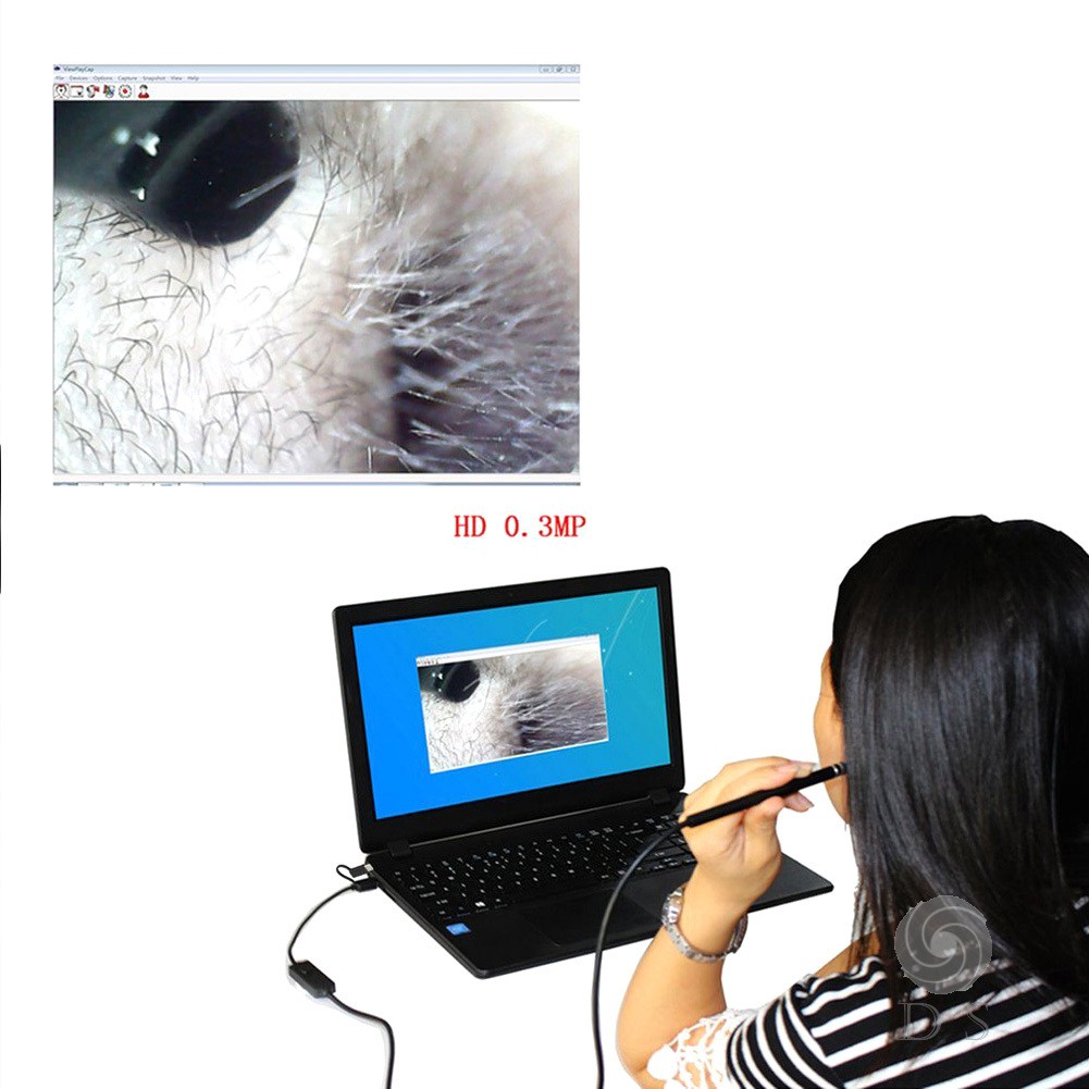 Bộ camera nội soi tai cổng USB HD kèm cây lấy ráy tai 2 trong 1