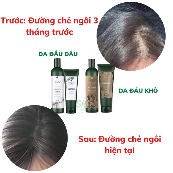 Dầu Gội Weilaiya Chính Hãng Gừng Thảo Dược Ngăn Rụng Tóc, Dau Goi Gừng Weilaiya Chống Rụng Tóc Cho Bầu Tóc Dầu T08