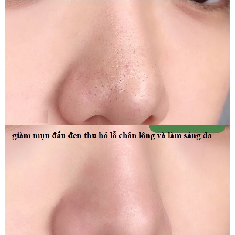 Mặt nạ TINH DẦU TRÀ XANH GREEN MASK STICK No.M906 tái tạo phục hồi da và giảm mụn [DẠNG SÁP SIÊU MỚI]