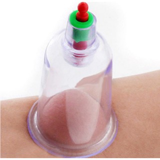 Bộ giác hơi không dùng lửa 12 cốc giác