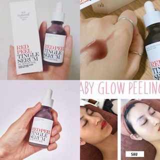 Tinh Chất Red Peel Tingle Serhm So Natural